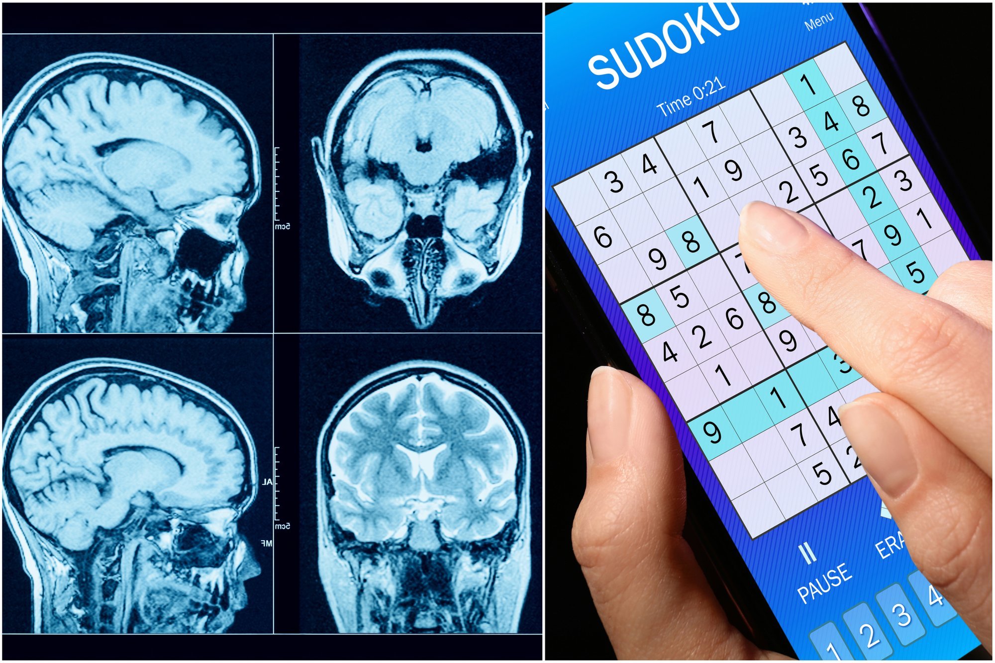 Sprend iate Sudoku Ar Kry ia od ius Neuromokslininkai Turi Blog ini 