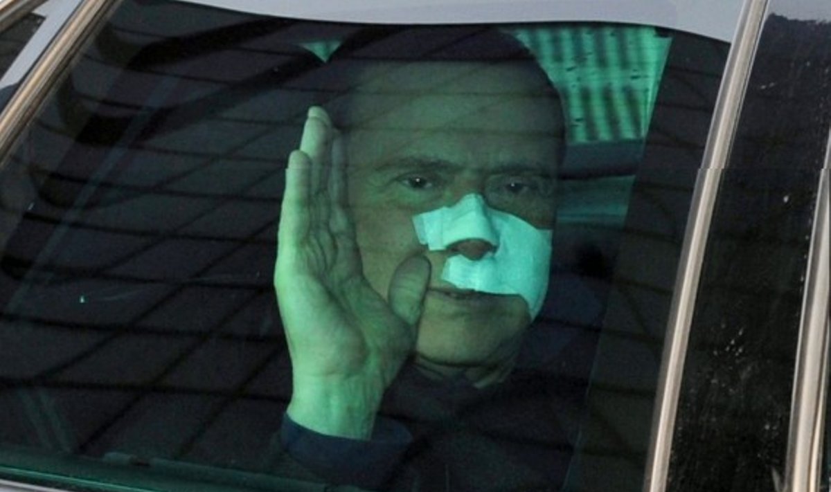 S.Berlusconi išrašytas iš ligoninės.