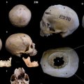 4000 metų senumo kaukolėje – milžiniška skylė ir pjūvių žymės: mokslininkai išsiaiškino, kas jam nutiko