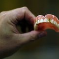 25 metų vaikinas neteko visų dantų - kasdien išgerdavo po 8 litrus kokakolos