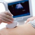 Radiologai paneigė mitus apie ultragarsinį tyrimą: kada jis atliekamas ir ką gali parodyti?