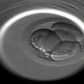 Mokslininkai siekia genetiškai modifikuoti žmogaus embrionus