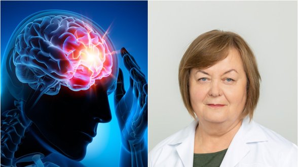 Neurologė – apie pavojingą smegenų ligą: delsiant gydyti gresia net demencija ar insultas