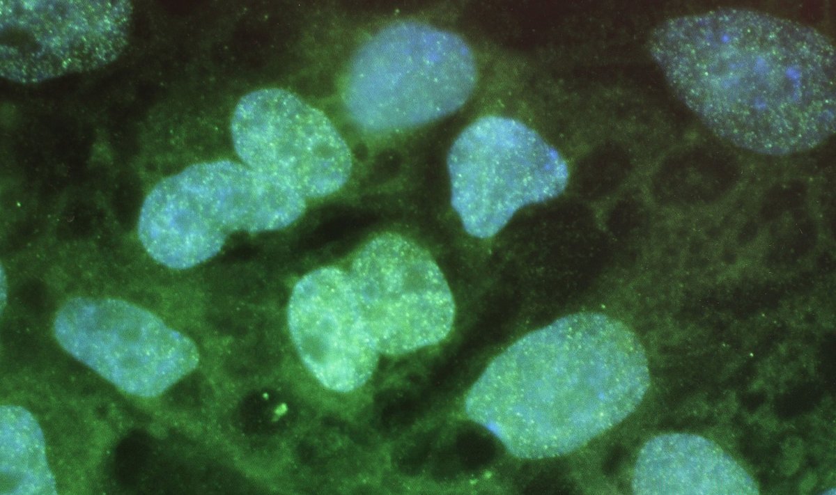 Žmogaus kamieninių ląstelių vaizdas per mikroskopą