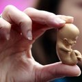 Bažnyčios hierarchai: abortas visuomet yra gyvybės atėmimas konkrečiam žmogui