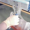 Lithuanian scientists develop technology to detect kidney disease