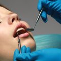 Lietuvoje pirmąkart atliktos unikalios dantų implantacijos operacijos