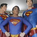 Filipinietis darosi plastines operacijas, kad taptų panašus į Supermeno aktorių Clarką Kentą