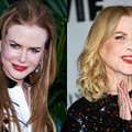 Grožio nesėkmė: kas nutiko Nicole Kidman veidui? FOTO