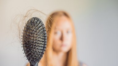 Specialistė įvertino prieš kelis dešimtmečius rekomenduotas priemones nuo plaukų slinkimo: verdiktas nustebins