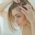 Genai ar gyvenimo būdas: gydytoja įvardijo dažniausias plaukų slinkimo priežastis