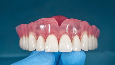Tai, ką svarbu žinoti apie dantų protezavimą: kokia suma gali būti kompensuojama ir kur kreiptis
