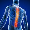 Specialistė patarė, kaip atskirti, kas sukėlė nugaros skausmą ir padėti sau be vaistų