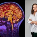 Šios žinios pravers ir darbe: mokslininkė paaiškino, kuo iš tiesų skiriasi abiejų lyčių smegenys