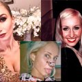 Balerina Kristina Tarasevičiūtė prabilo apie nosies operaciją: investavo pirmus uždirbtus pinigus