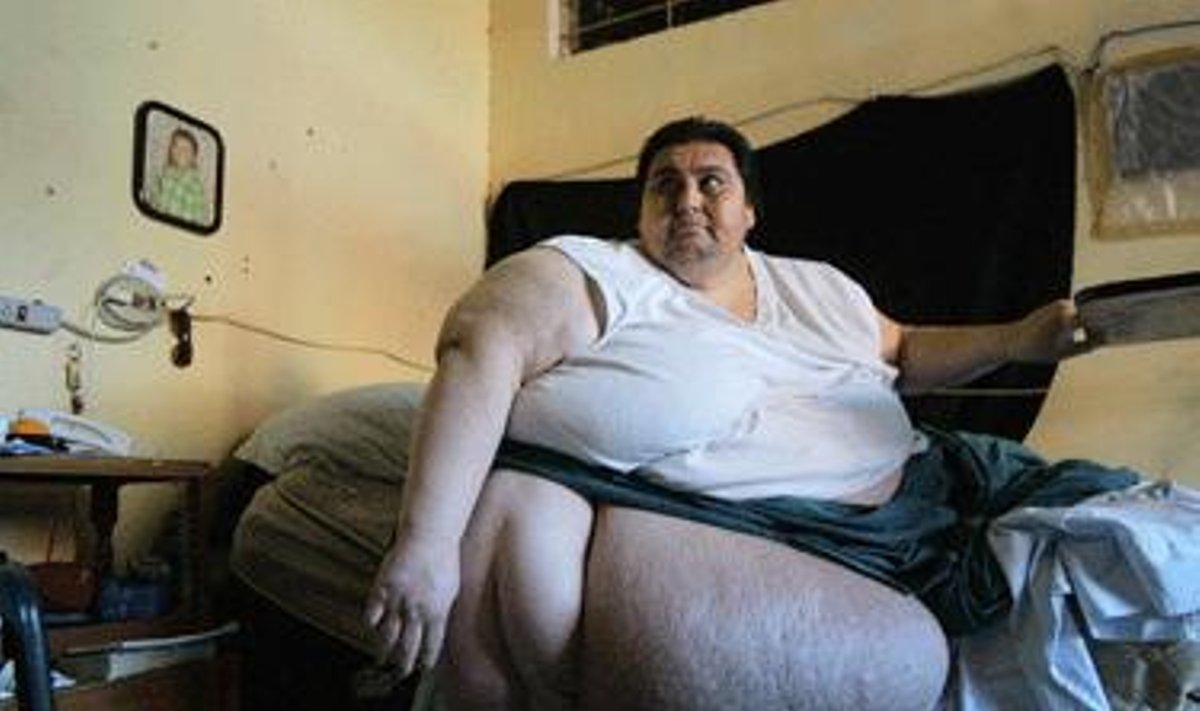 Meksikietis Manuelis Uribesas sėdi savo namuose ant lovos. Vyriškis sveria 550 kilogramų ir greičiausiai yra sunkiausias žmogus pasaulyje. Jis tikisi nukeliauti į Italiją, kurios medikai atliktų jo gyvybę išgelbėsinčią operaciją.