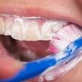 Ar taisyklingai išsivalote dantis: patarė, koks dantų šepetėlis ir pasta geriausi