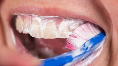 Ar taisyklingai išsivalote dantis: patarė, koks dantų šepetėlis ir pasta geriausi