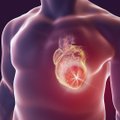 Koronavirusas smogia širdžiai: Lietuvoje ženkliai išaugs mirčių skaičius nuo širdies ir kraujagyslių ligų