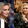 Naujausios Madonnos nuotraukos sukėlė gerbėjų susirūpinimą: paaiškino, kodėl galėjo pakisti popkaralienės išvaizda