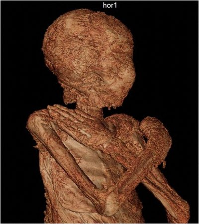 Mumijos tyrimai Lenkijoje.