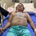 Brazilijos prezidentas toliau gydomas ligoninėje, jo būklė gerėja