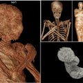 Mumiją kompiuteriniu tomografu nuskenavę lenkų mokslininkai jos viduje aptiko pribloškiantį radinį: objektas išsilaikė lyg užkonservuotas