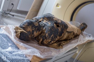 Mumijos tyrimai Lenkijoje.