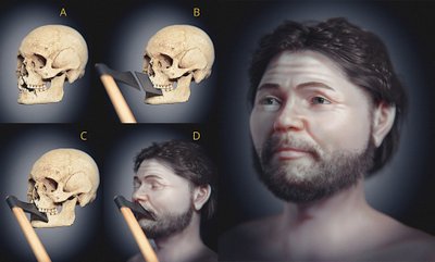 Viduramžių laikų kaukolės veido rekonstrukcija rodo, kad žuvusiajam mūšyje veikiausiai buvo suduotas mirtinas smūgis kirviu. Cícero Moraes/Thiago Beaini/Thomas Hvashoj Steffensen/Michel Dalstra iliustr.