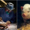 Eksperimentą atlikę JAV mokslininkai tai pavadino stebuklu: pirmą kartą istorijoje gyvam žmogui įsodinti kiaulės inkstai