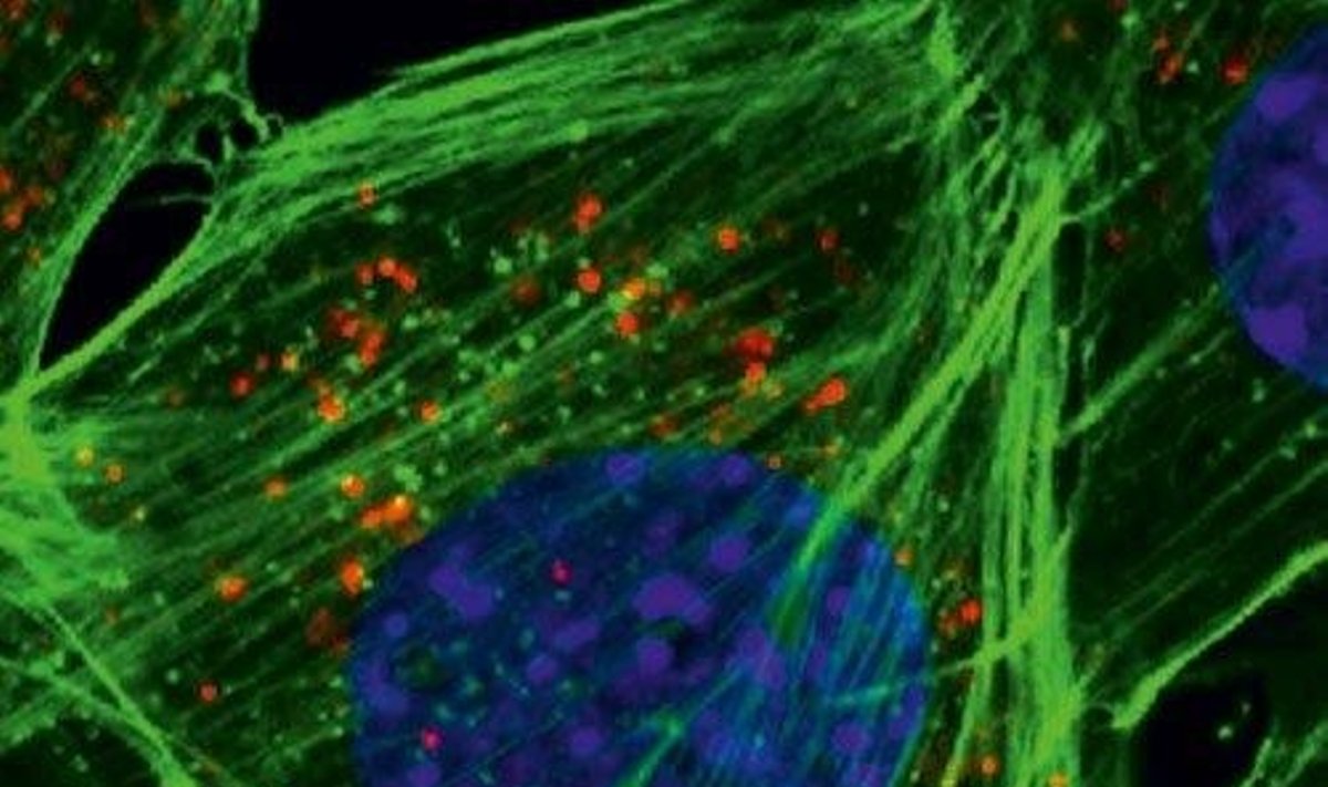 Mėlynai pavaizduotas ląstelės branduolys, žaliai – ląstelės citoskeletas. Oranžiniai taškeliai ląstelėje – nanodalelių sankaupos. V.Karabanovo nuotr.