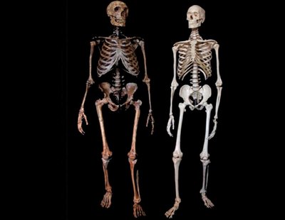 2020 metais S. Pääbo paskelbė tyrimą, kuriame teigiama, kad COVID-19 sergantiems pacientams, turintiems neandertaliečių DNR fragmentą, kyla didesnė sunkių ligos komplikacijų rizika.