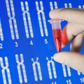 Ar sveika valgyti DNR?