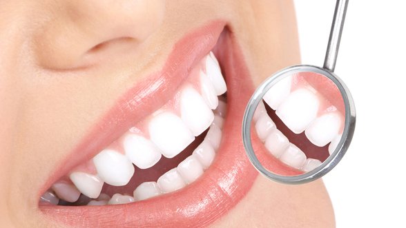 Instead of a white smile - colorful teeth. On unprofessional teeth bleaching