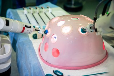 Robotinė operacija Santaros klinikose. Pilvo muliažas su į jį įvestomis roboto „rankomis“