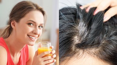 Dažyti nereikės: gera žinia toms, kurios kenčia dėl žilų plaukų