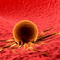 Lietuviai vėžį gydo ląstelėmis žudikėmis