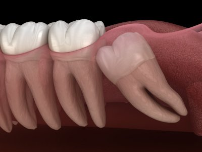 Protiniai dantys