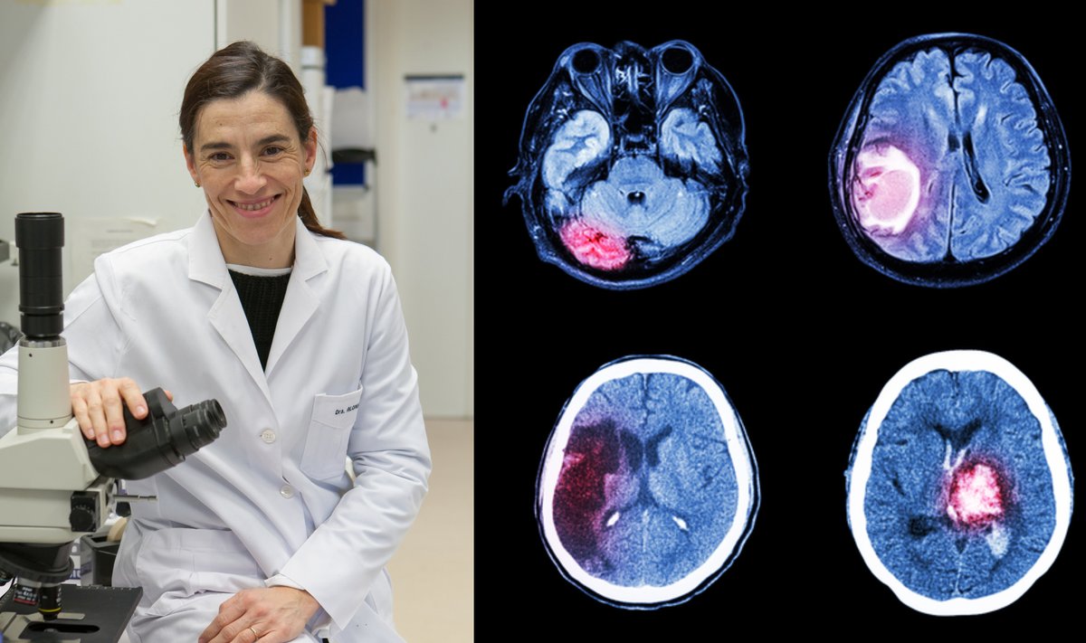 Prof. Marta Alonso tyrinėja smegenų auglius. Universidad de Navarra/Manuel Castells/Shutterstock nuotr.