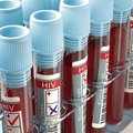 Lietuvoje kone dukart padaugėjo ŽIV atvejų
