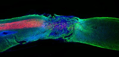Su pelėmis išbandyto paralyžiaus gydymo būdo pagrindą sudaro sintetinės nanoskaidulos, ilgainiui virstančios ląstelių maistu ir galiausiai pašalinamos iš organizmo. Vida Press/Scanpix nuotr. 10881