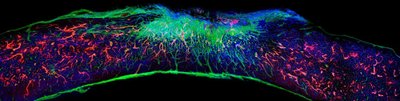 Su pelėmis išbandyto paralyžiaus gydymo būdo pagrindą sudaro sintetinės nanoskaidulos, ilgainiui virstančios ląstelių maistu ir galiausiai pašalinamos iš organizmo. Vida Press/Scanpix nuotr. 10880