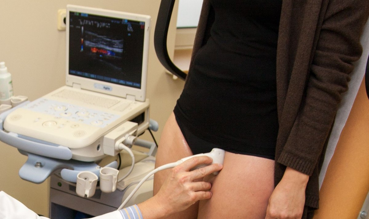Gijos Klinikos venų tyrimas ultragarsu