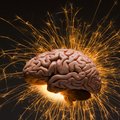 Patikimiausias būdas intelektui išmatuoti – smegenų skenavimas?