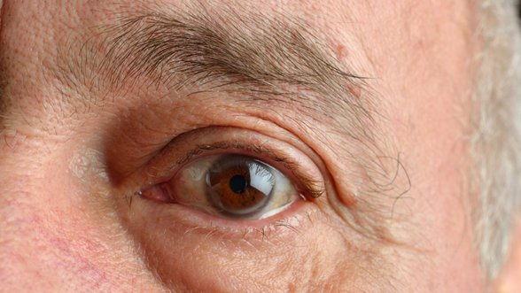 Svarbiausios taisyklės, kaip prižiūrėti akis vasarą: apsaugos ir nuo sausumo, ir nuo rimtų ligų