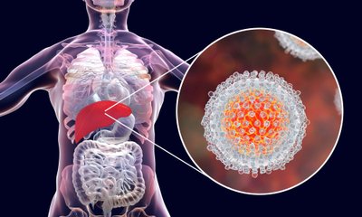 Hepatito virusas gali pažeisti kepenis