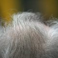 Atradimas, užkirsiantis kelią žiliems plaukams