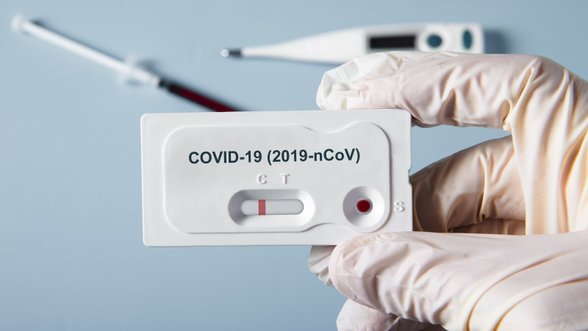 Mokslininkų verdiktas: greitieji testai koronaviruso diagnostikai netinka