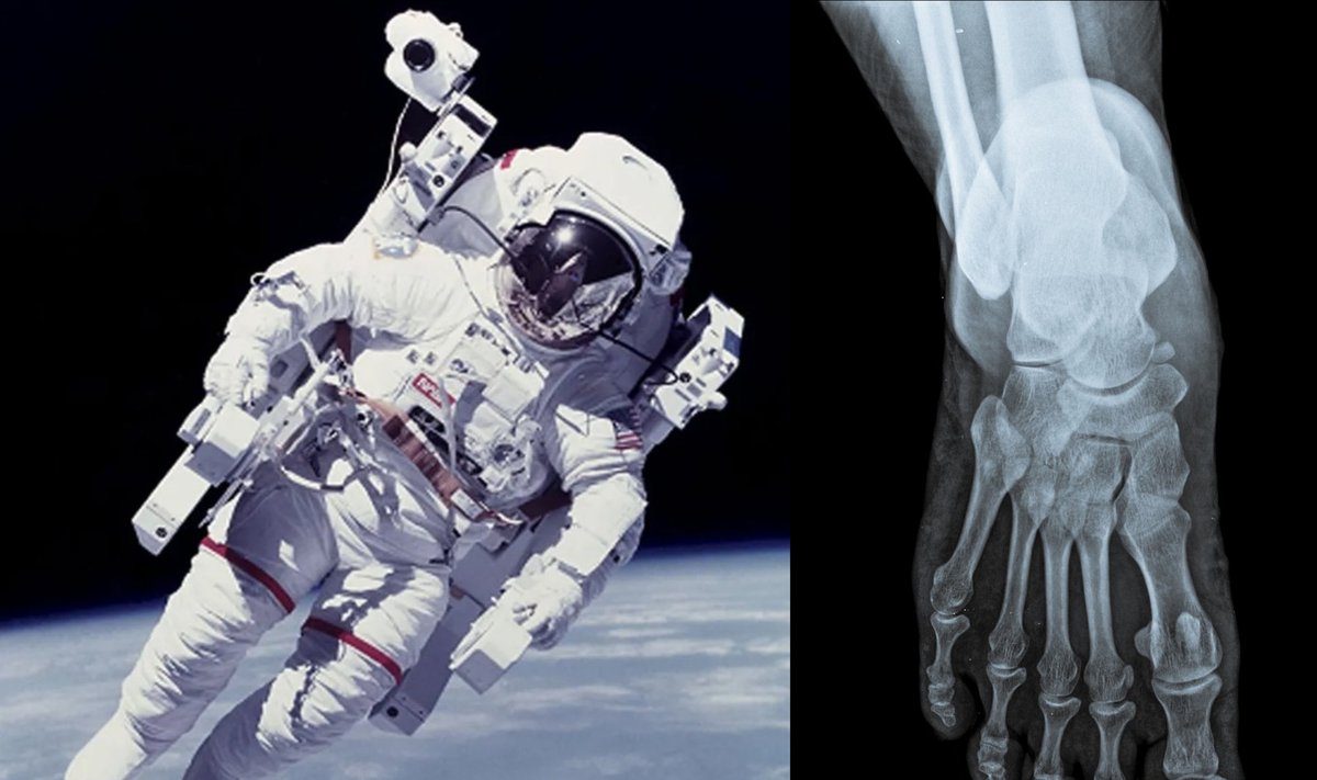 Astronautams kosmose prasideda osteoporozė.