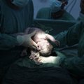 Cezario pjūvio operacijos pasiekė epidemiją: patogu motinai, bet pragaištinga kūdikiui
